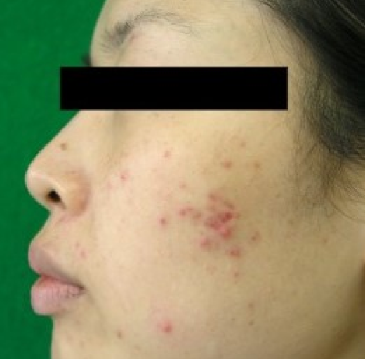 Before/After Image